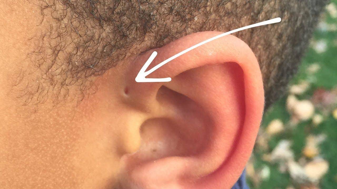 आपके कान में छेद है तो आपको हो सकते हैं कई खतरें, जानिये