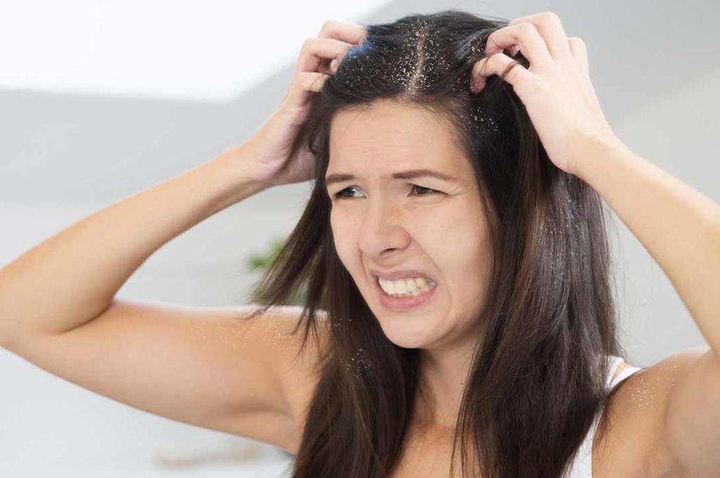 Hair Tips: रूसी से छुटकारा पाना मुश्किल नहीं है, घरेलू उपचार इस समस्या का समाधान है