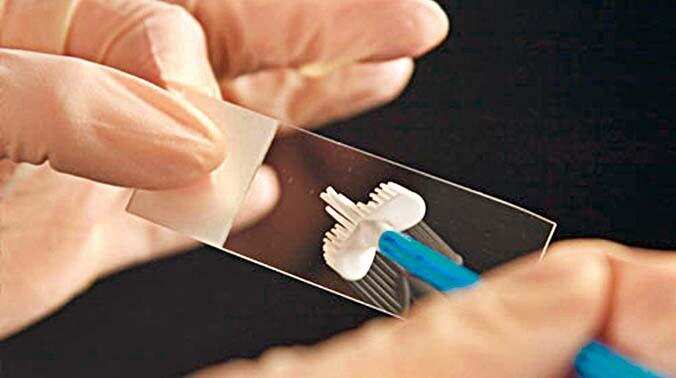 जानें क्या होता है पैप स्मीयर टेस्ट और किस लिए किया जाता है यह टेस्ट