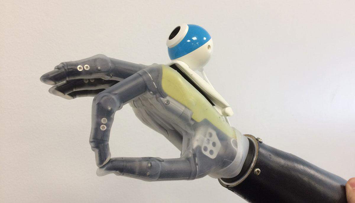 बिना सर्जरी के काम करेगा, नई तकनीक पर आधारित यह कृत्रिम हाथ