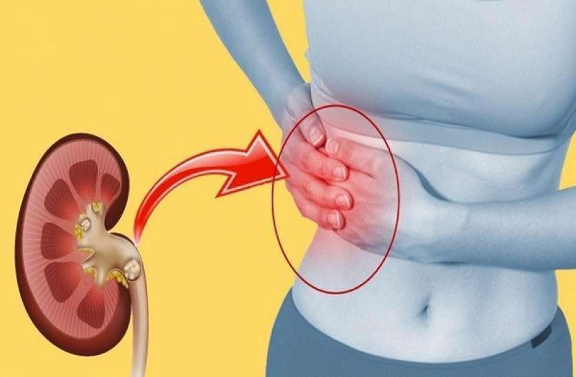 Kidney Stone: गुर्दे की पथरी से पीड़ित? फिर, गलती से भी यह खाना न खाएं