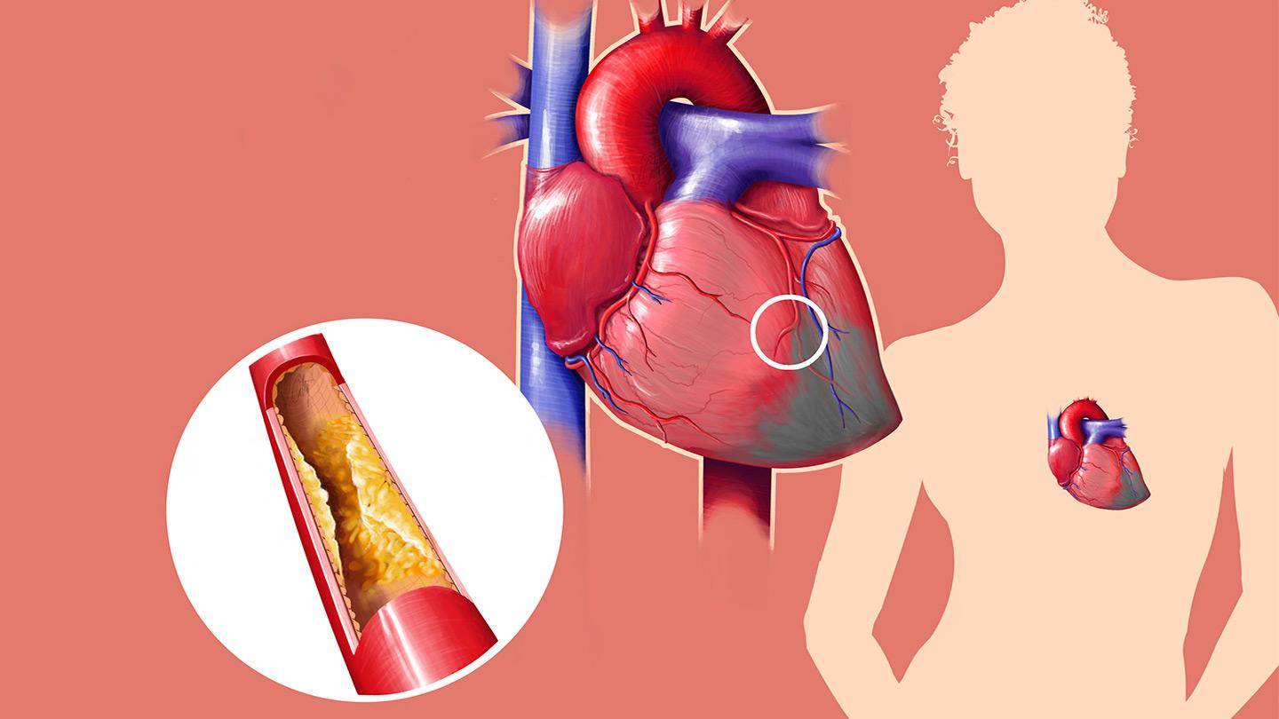 टमाटर से घटाए कोलेस्ट्रोल, दूर रहेगी दिल की बिमारी