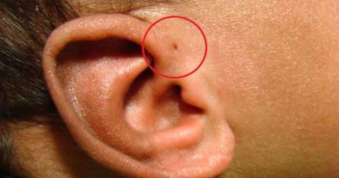 आपके कान में छेद है तो आपको हो सकते हैं कई खतरें, जानिये