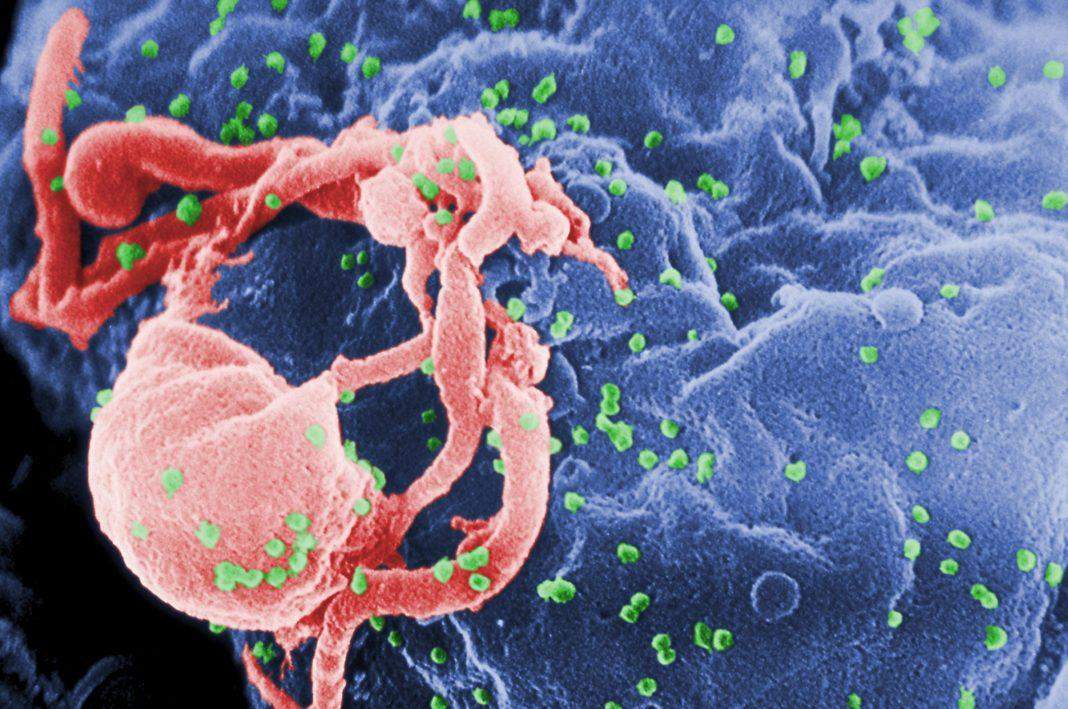 एचआईवी वायरस का जड़ से खात्मा करेगी ये नई तकनीक