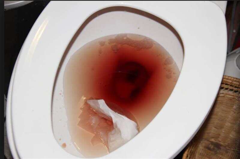 अगर आता है पैशाब में खून तो हो सकती है ये समस्या