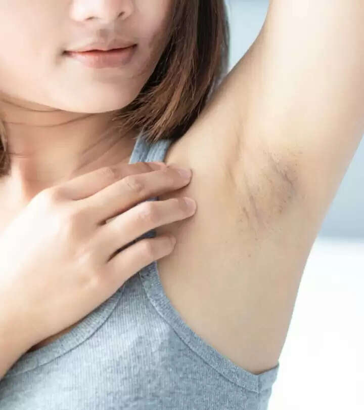 home remedies: घरेलू तरीके से करें बगल के काले धब्बों को दूर