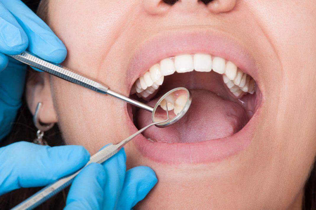 दांतों के कीड़े और पुराने से पुराने दातों का दर्द दूर करने के लिए अपनाएं यह नुस्खा.