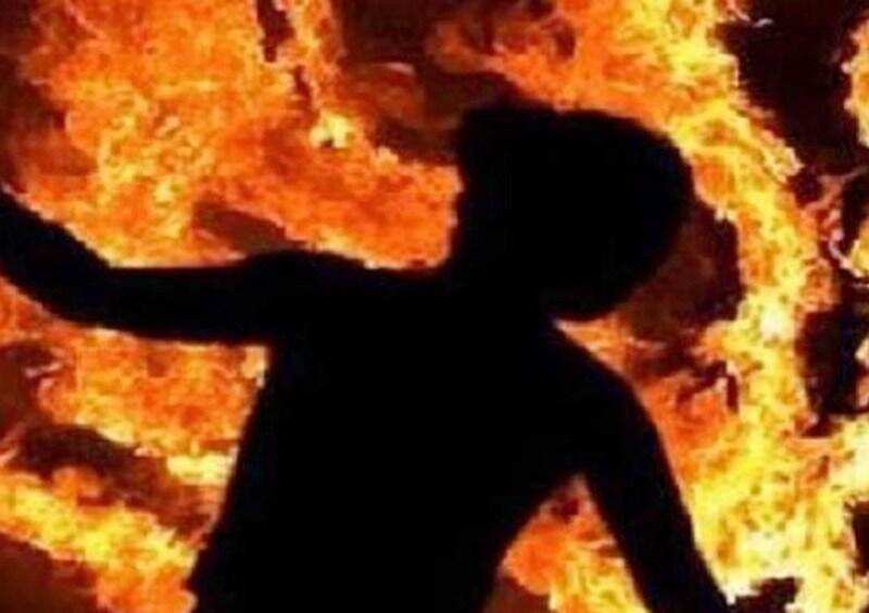 दिवाली पर हो गया है पटाखे चलते समय बर्न तोह ध्यान में रखें ये बात 