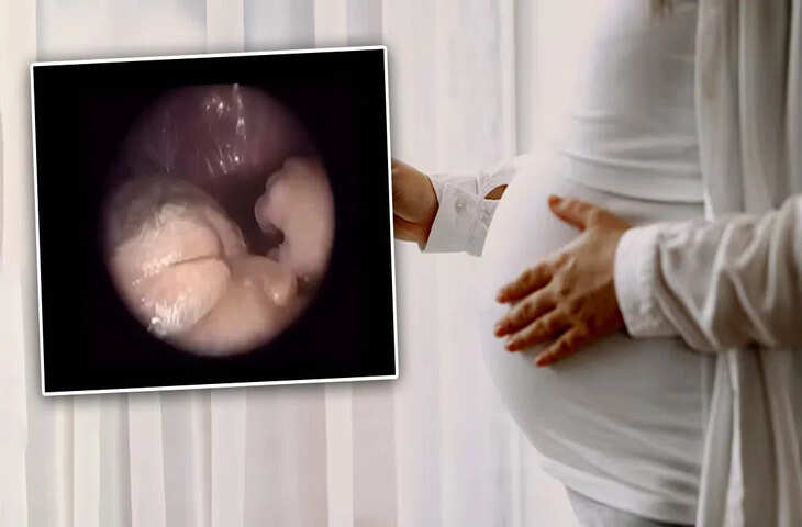 गर्भ में शिशु के विकास का अद्भुत नज़ारा, आधुनिक तकनीक ने खोला जीवन के पहले सफर का रहस्य