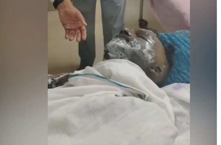 सवाई माधोपुर में दर्दनाक हादसा, झुलसने से युवक की मौत से इलाके में सनसनी