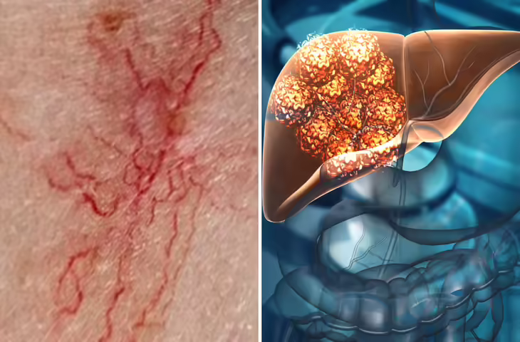 Skin Symptoms of Liver Damage: चेहरा, होंठ और त्वचा का रंग बदलने लगे तो सावधान! लिवर बिगड़ने की हो सकती है शुरुआत​​​​​​​