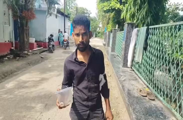 कोबरा ने डसा तो घबराया नहीं युवक, जिंदा सांप को डिब्बे में बंद कर पहुंचा अस्पताल, मचा हड़कंप