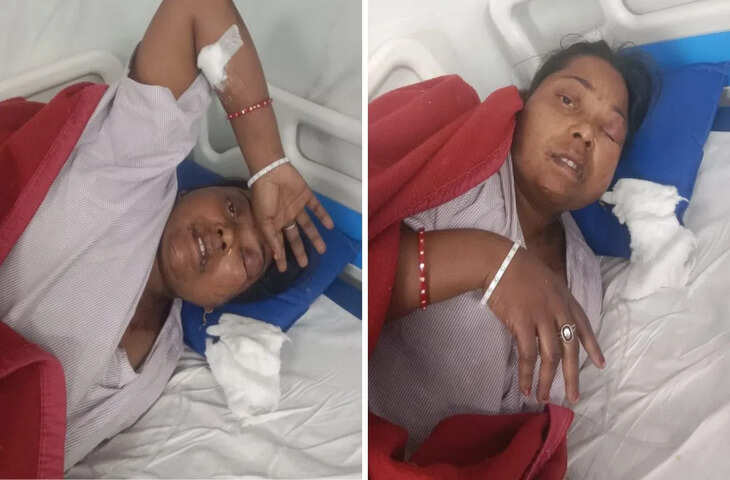 5 साल बाद दिल्ली से भागलपुर लौटा पति&hellip; बीवी पर फेंका तेजाब, फिर खुद कर लिया सुसाइड