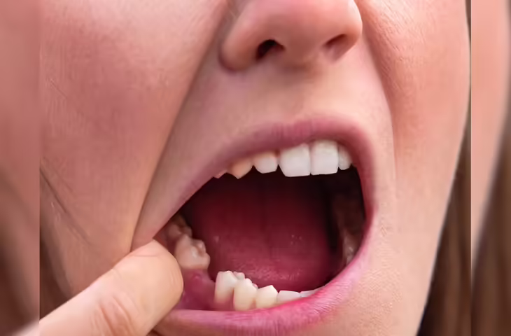 जापान के वैज्ञानिकों की इस नयी खोज से दुनिया में खलबली: अगले 4 साल में इंसान फिर उगा सकेगा टूटे हुए दांत, ह्यूमन ट्रायल्स भी शुरू&nbsp;