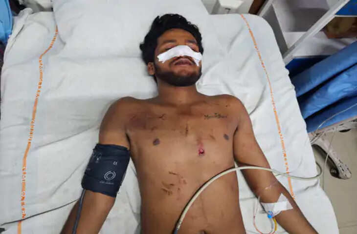 मंदसौर में सड़क हादसा: किराना लेकर लौट रहे पिता-पुत्र को पीछे से वाहन ने मारी टक्कर, 25 वर्षीय युवक गंभीर घायल