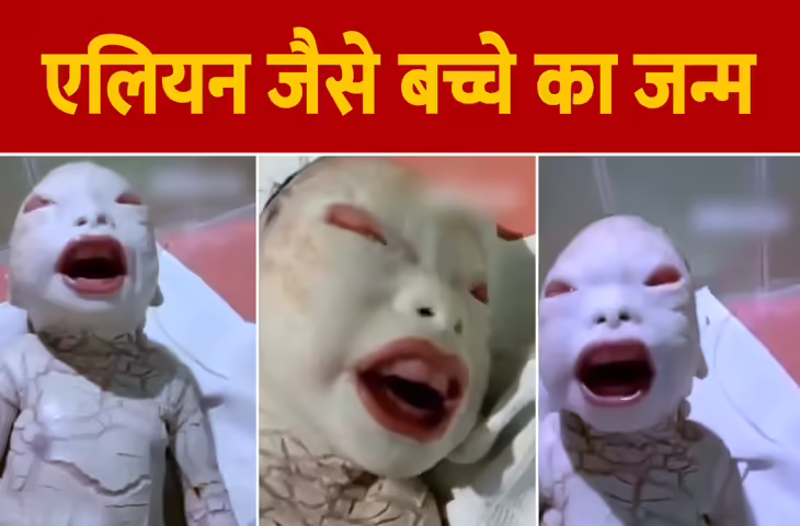 बस्ती मेडिकल कॉलेज में जन्मा अनोखा बच्चा, लोगों ने बताया एलियन, डॉक्टर भी हैरान