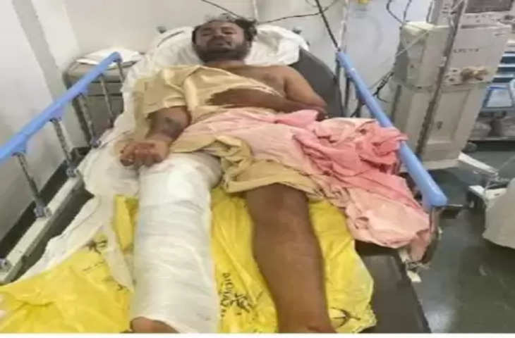 Karnataka में तेजाब हमलावर गिरफ्तार, भागने के दौरान पुलिस ने पैर में मारी गोली