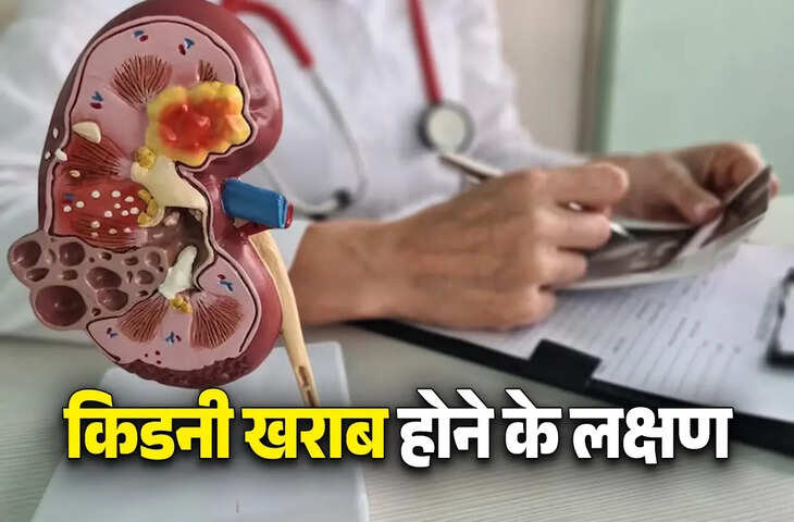 Health Alert: Kidney Disease के शुरुआती संकेत न करें नजरअंदाज, ये लक्षण समय रहते पहचानें​​​​​​​