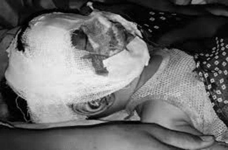 बांसवाड़ा में दिल दहला देने वाली घटना: घर में घुसा सियार, 6 माह के बच्चे पर हमला