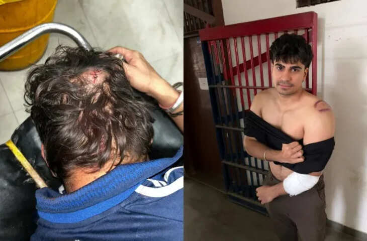 Jaipur: डांस क्लब में MBBS छात्रों पर हमला, बाउंसरों ने डंडों-रॉड से जमकर पीटा, 10 स्टूडेंट घायल, 1 की हालत गंभीर