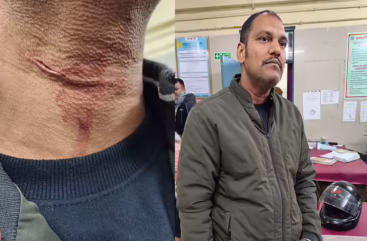 लखनऊ में चीनी मांझे से युवक घायल, गर्दन कटने से बचा
