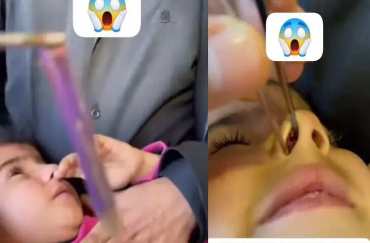 खेल-खेल में बच्ची ने नाक में घुसा ली पेंसिल, डॉक्टर ने इस तरह निकाला बाहर