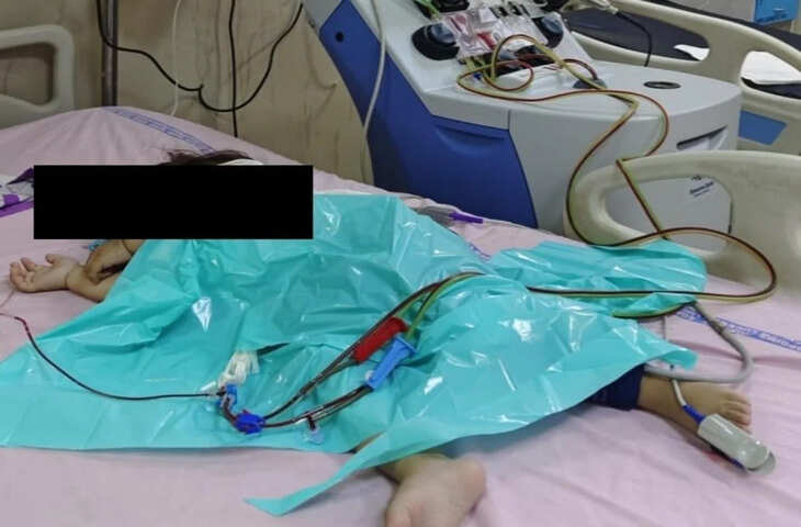 3 साल के बच्चे के खून में बढ़ गया था जानलेवा कोलेस्ट्रॉल, लखनऊ PGI के डॉक्टरों ने बचाई जान