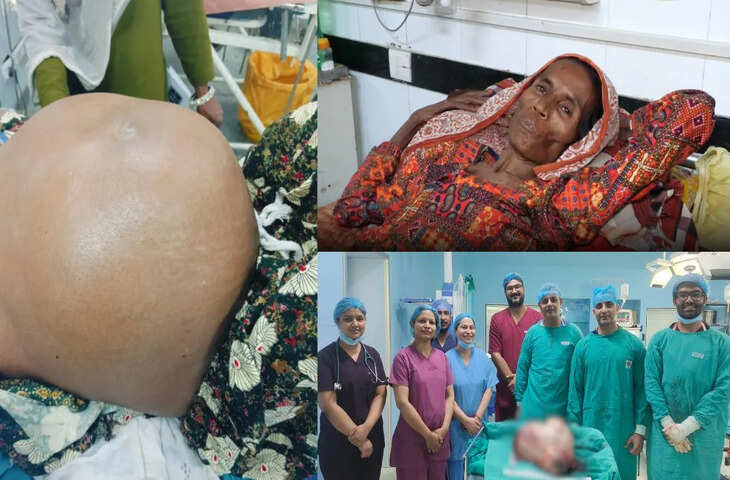 70 वर्षीय महिला के पेट से निकला 10 किलो का ट्यूमर, डॉक्टरों ने सफल ऑपरेशन कर दी नई जिंदगी