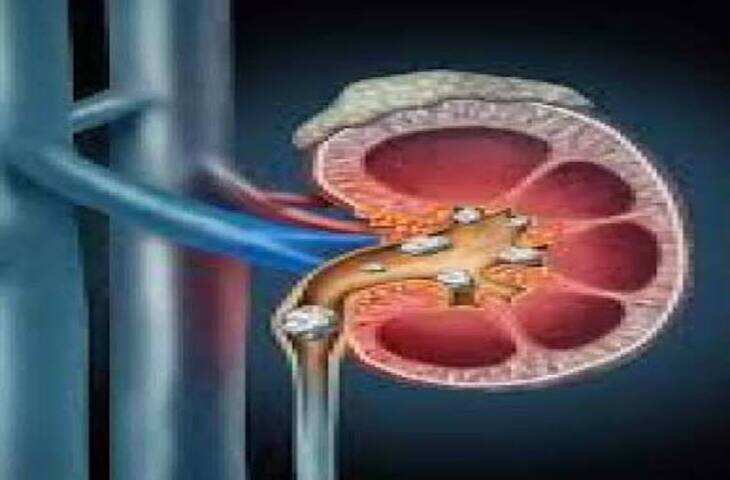 Gallstones Emergency: क्या पित्त की पथरी का ऑपरेशन तुरंत कराना जरूरी है? जानिए सच!