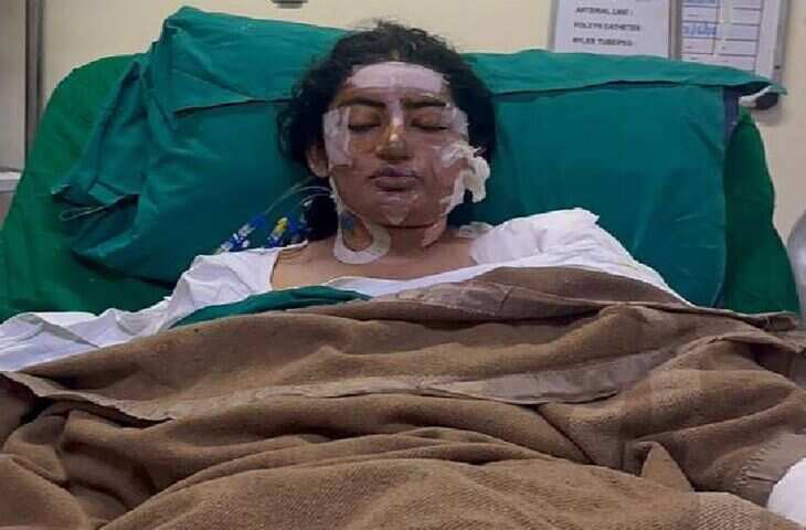 इंदौर गैस पाइपलाइन हादसा: कंटेंट क्रिएटर जिनी झाला को एयरलिफ्ट कर अहमदाबाद रेफर, जाइडस हॉस्पिटल में चलेगा इलाज