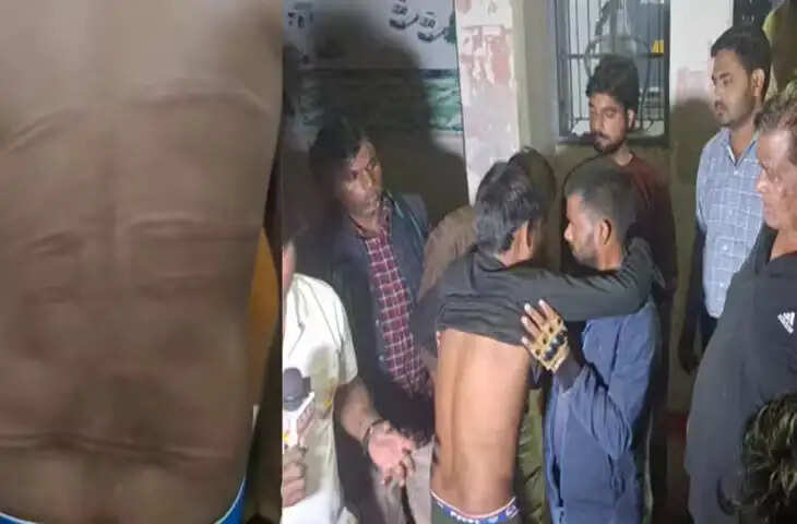 वाहन चेकिंग के दौरान विधायक का नाम सुनते ही पुलिस ने युवक पर बरसाईं लाठियां, हालत गंभीर