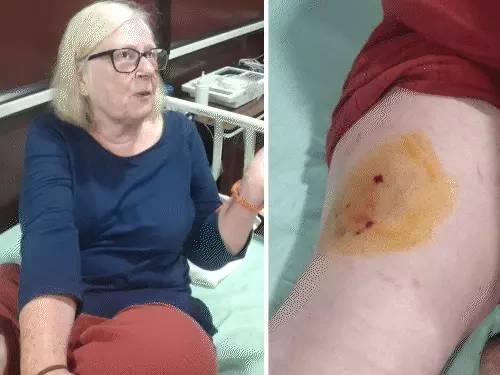 ताजमहल घूमने पहुंची UK की महिला पर्यटक पर बंदर का हमला, हाथ में काटा; लोगों ने बचाया