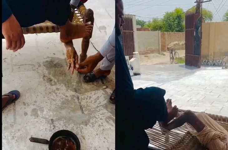 वाह रे पाकिस्तान! ‘डॉक्टर’ ने लकवाग्रस्त मरीज का पैरों से किया अजीबोगरीब इलाज, VIDEO देख लोगों ने पीट लिया माथा