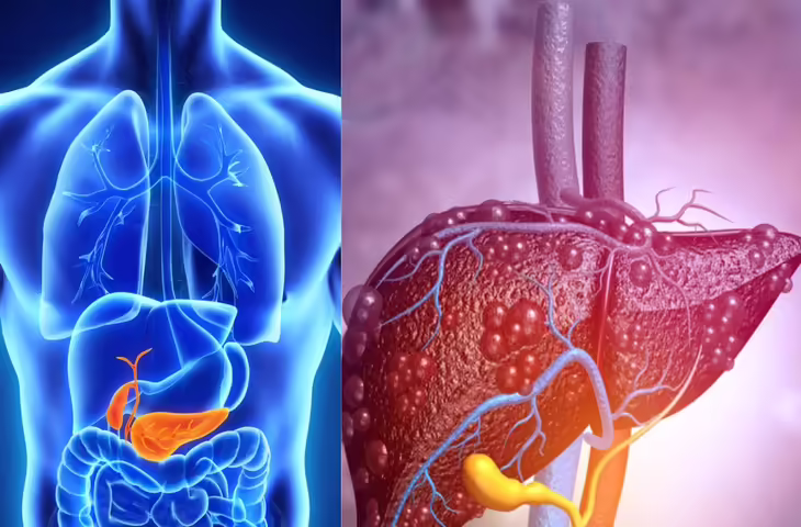 Fatty Liver Disease: आपकी ये 8 आदतें बना सकती हैं लिवर को बीमार, तेजी से बढ़ रहे हैं मामले​​​​​​​