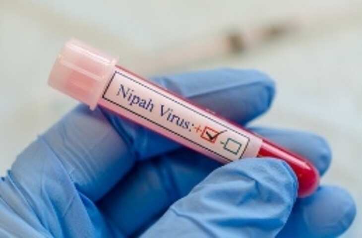Nipah Virus अधिक सैंपल की जांच निगेटिव आने से कोझिकोड में निपाह वायरस का डर खतरा कम, अलर्ट जारी