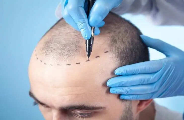 भारत आया पाकिस्तानी आतंकी उस्मान उर्फ जट्टी, हेयर ट्रांसप्लांट करवाने का खुलासा; पूछताछ में कई चौंकाने वाले दावे