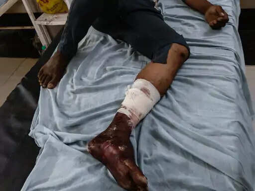 ट्रैक्टर चलाने को लेकर विवाद में युवक पर लाठी-डंडों से हमला, पैर में फ्रैक्चर