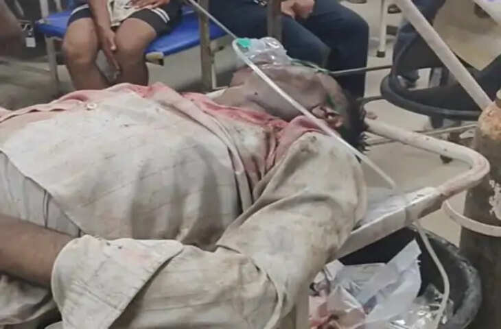 हाथरस में दो सड़क हादसे, तीन लोग गंभीर रूप से घायल; अलीगढ़ रेफर
