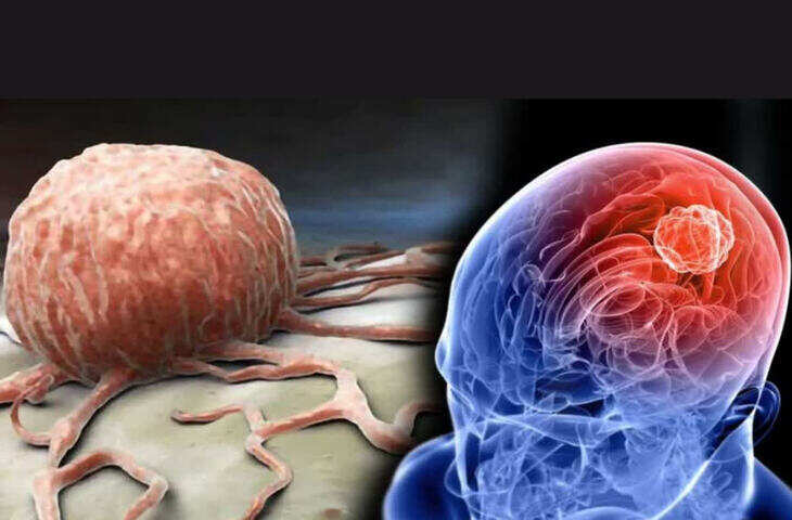 WHO Brain Health Tips: भूलने की समस्या से बचना है? दिमाग को हेल्दी रखने के लिए अपनाएं ये आसान आदतें