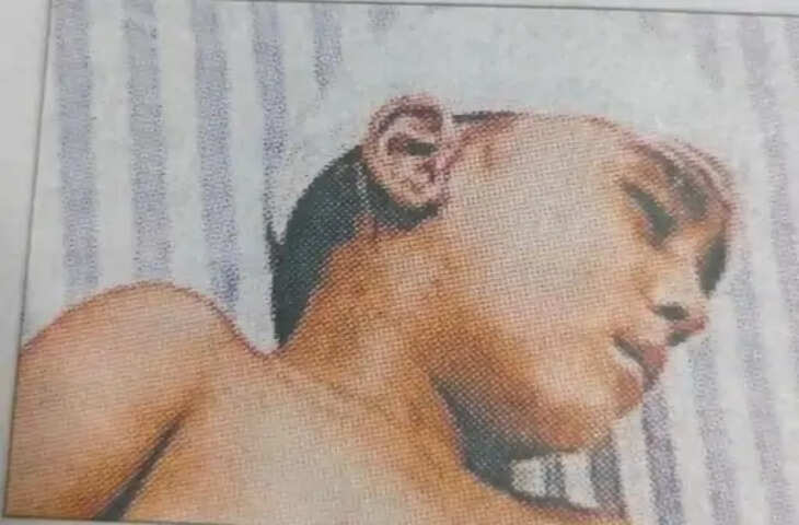 मेरठ में दिल दहला देने वाली वारदात: नशे में युवक ने 4 साल के मासूम पर किया जानलेवा हमला, सिर में फ्रैक्चर