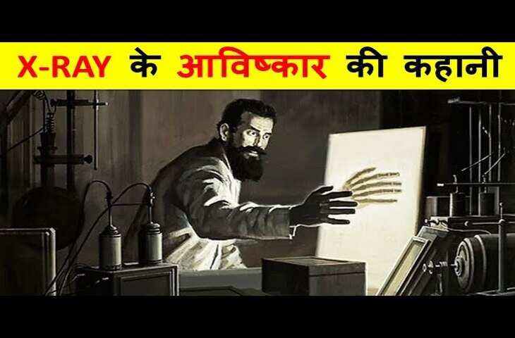 एक गलती या संयोग? कैसे एक वैज्ञानिक हादसे ने दुनिया को दिया X-Ray, जिससे बिना चीर-फाड़ शरीर के अंदर झाँक सकते है&nbsp;