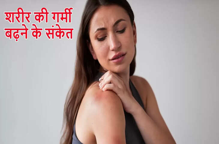 अगर हद से ज्यादा बड़ जाये गर्मी तो शरीर पर दिखने लगते हैं यह लक्षण,जाने इससे बचने का तरीका&nbsp;