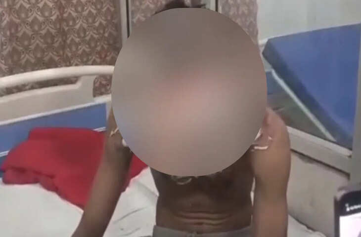 थाना गेट पर डिलीवरी बॉय ने किया आत्मदाह का प्रयास, अस्पताल में भर्ती