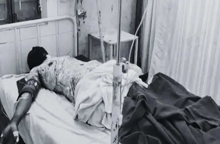 अलवर: पत्नी के जान के बाद युवक ने चुना मौत का रास्ता, केरोसिन डालकर खुद को लगा ली आग