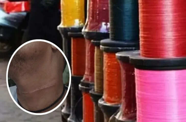 महाराष्ट्र में चाइनीज मांझे से कटी शख्स की गर्दन&hellip; बाल-बाल बची जान, लोगों ने जताई नाराजगी