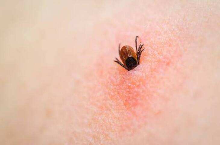 Tick Removal Tips: त्वचा पर चिचड़ी चिपक जाए तो क्या करें? जानें सुरक्षित और आसान तरीका