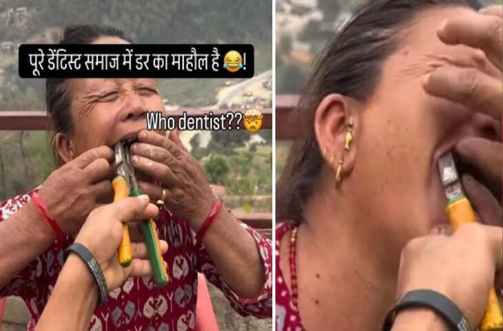 वीडियो देख छूट जाएगी कंपकंपी: बिना सुन्न किए प्लास से दांत निकाल दिया,&nbsp;डेंटिस्ट समाज में डर का माहौल