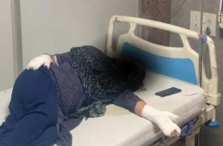 अजमेर में गैस रिसाव से घर में भीषण आग, खाना बना रही महिला सहित तीन लोग गंभीर रूप से झुलसे