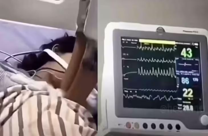 महिला डॉक्टर की मेहनत से मरीज ने मौत को मात दी, 30 मिनट तक CPR का चौंकाने वाला वीडियो