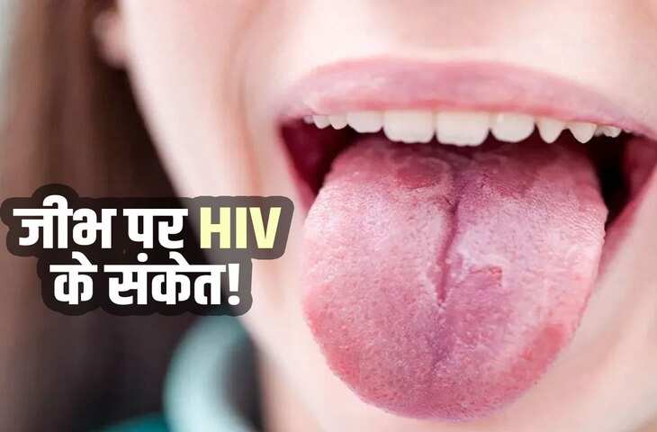 AIDS Symptoms in Women: महिलाओं में HIV संक्रमण के बाद शरीर में दिख सकते हैं ये बड़े बदलाव, त्वचा और जीभ के संकेत भी हैं अहम
